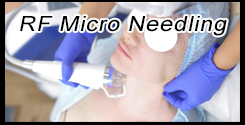 RF Micro Needling / Fractional